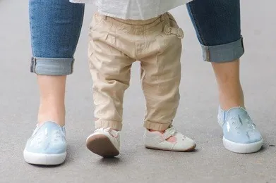 什么样的八字脚需要治疗?