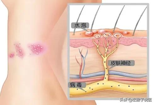 哪种疾病最让人疼痛？经历过这4种疼痛，才最让人痛不欲生