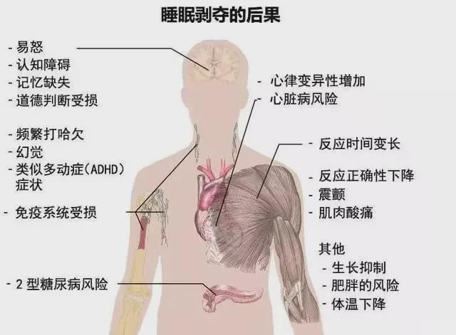 熬夜看世界杯猝死(27岁女网红在飞机上猝死！早死率飙升！年轻人，你的命没那么硬)