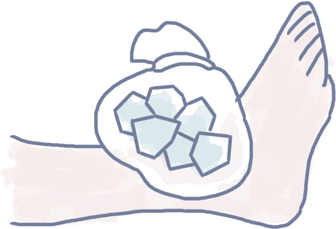 用冰袋或用毛巾包裹冰块外敷患处.