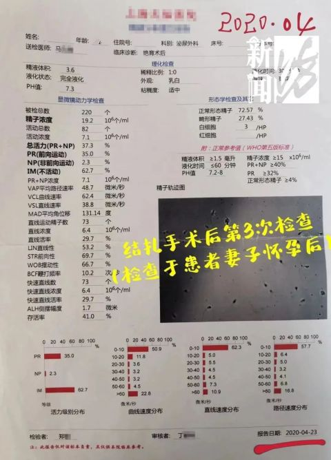 男人结扎后，和正常人有什么不一样？会影响性功能吗？涨知识了