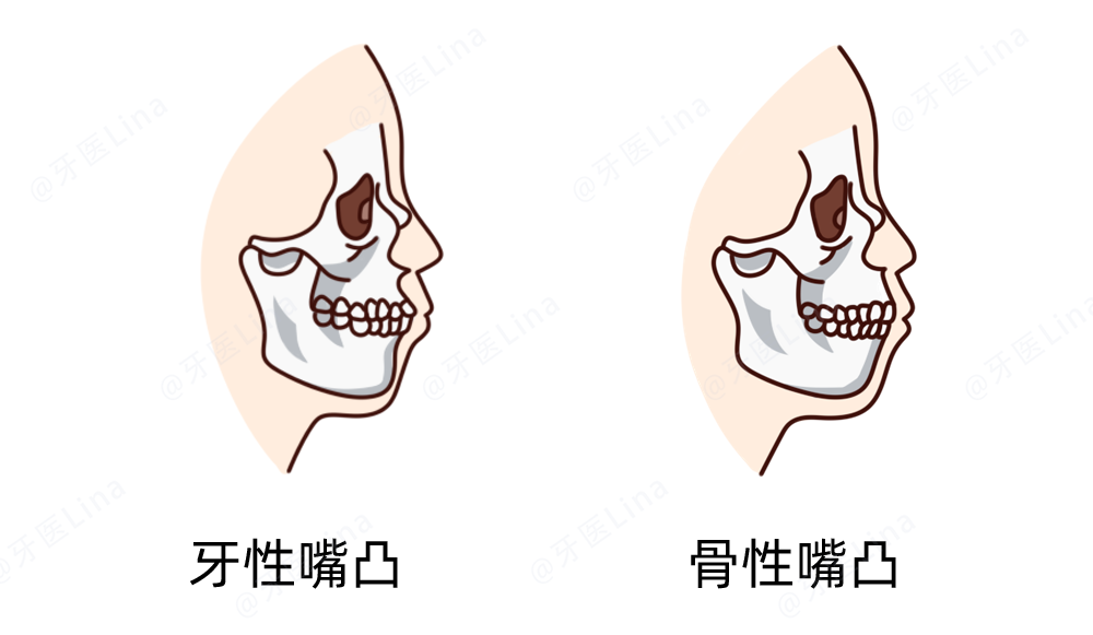 换头，了解一下？