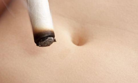 冬季时节，宜灸神阙