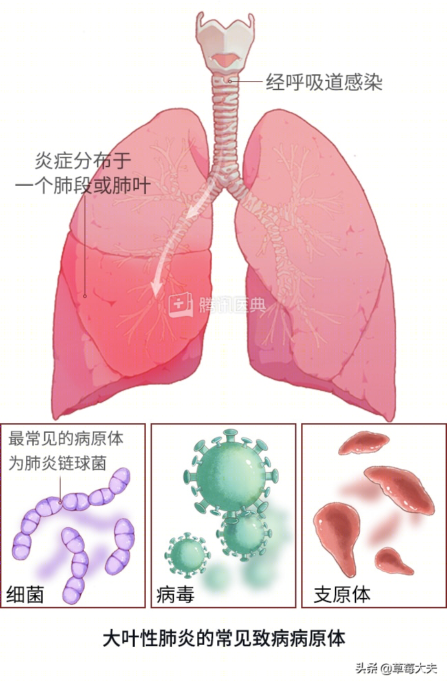 孩子咳嗽两个多月都不好，医生让我试试给孩子肺“洗澡”？