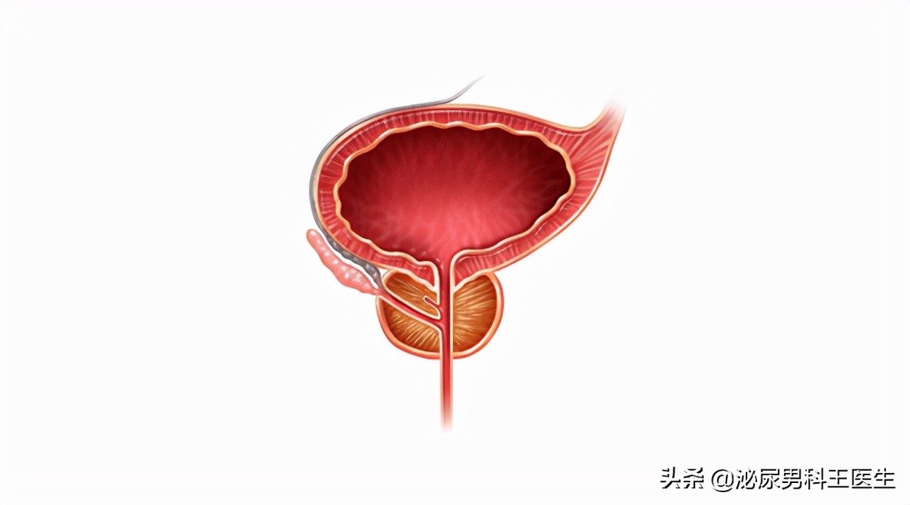 前列腺大了该怎么办——谈谈前列腺增生