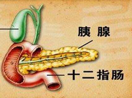 胰腺癌是癌中之王，胰腺癌的病因大揭秘，告诉你预防办法