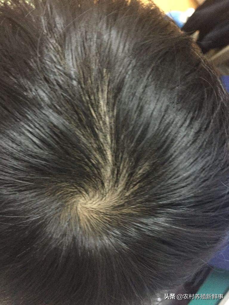 关于头顶的旋还有哪些俗语关于头上的旋的俗语