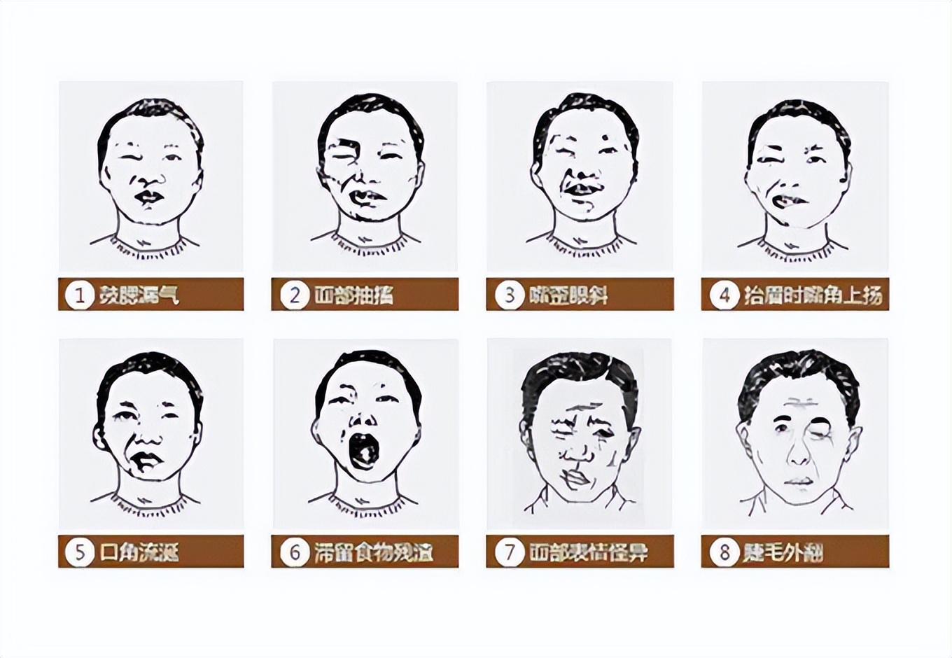 左边脸有点麻怎么回事(脸部发麻) - seo葵花宝典