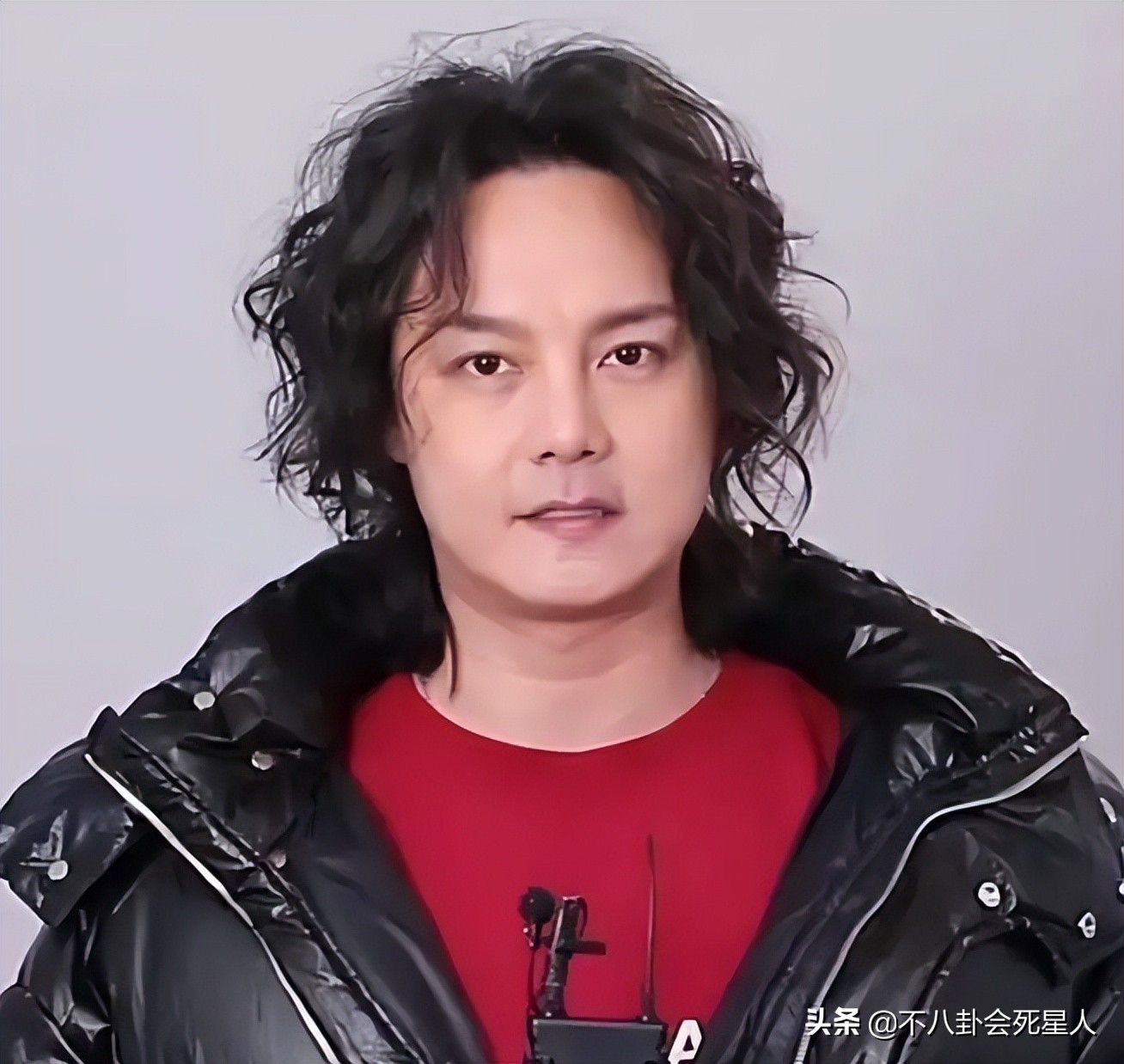 内娱新晋“发面馒头”，肿胀僵硬没眼看，让动脸前辈们自愧不如