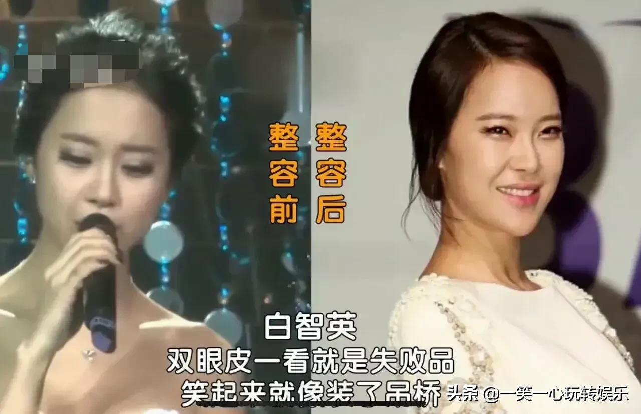 韩国明星变美“后遗症”，朴春360度崩盘，李多海变僵尸脸