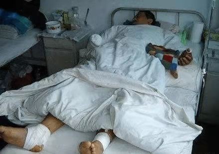 10年前东北校园致命篮球，父母为给儿子撑腰：使劲砍我不差钱