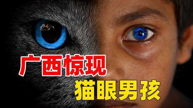 广西10岁"猫眼男孩",竟然长了一双夜视眼!晚上看东西如同白天