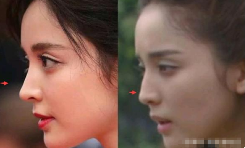 演艺圈“花式鼻子”大比拼，又尖又翘又吓人，一个比一个精彩