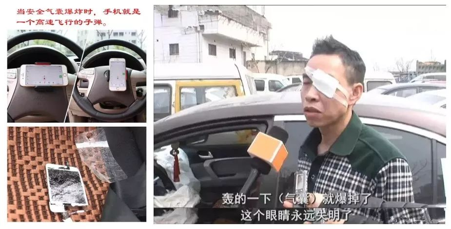 可怕，英女子坐副驾翘脚，安全气囊以200km/h爆开，股骨插进屁股