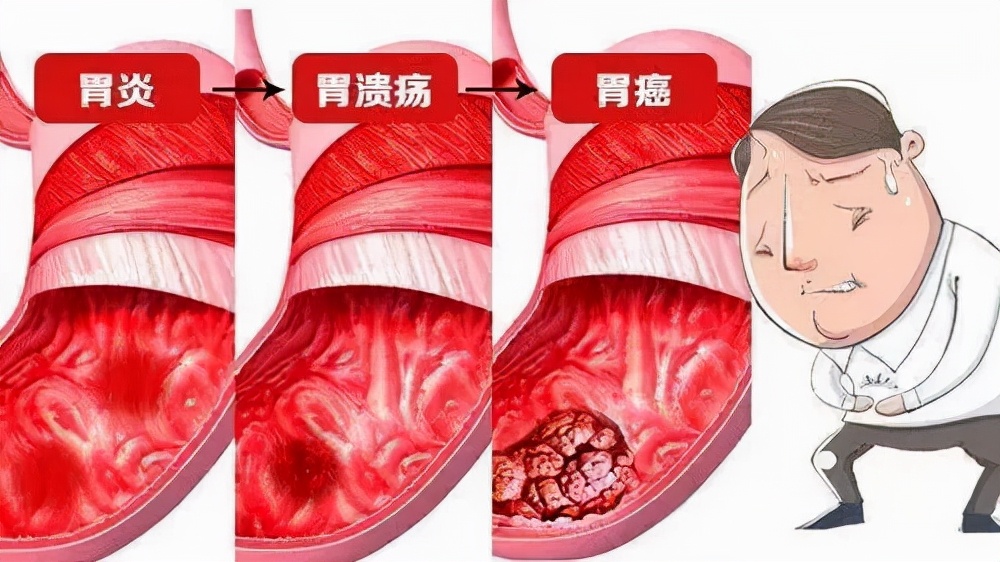 喝酒喝到胃出血该怎么办?不管不顾,可能会引发胃癌