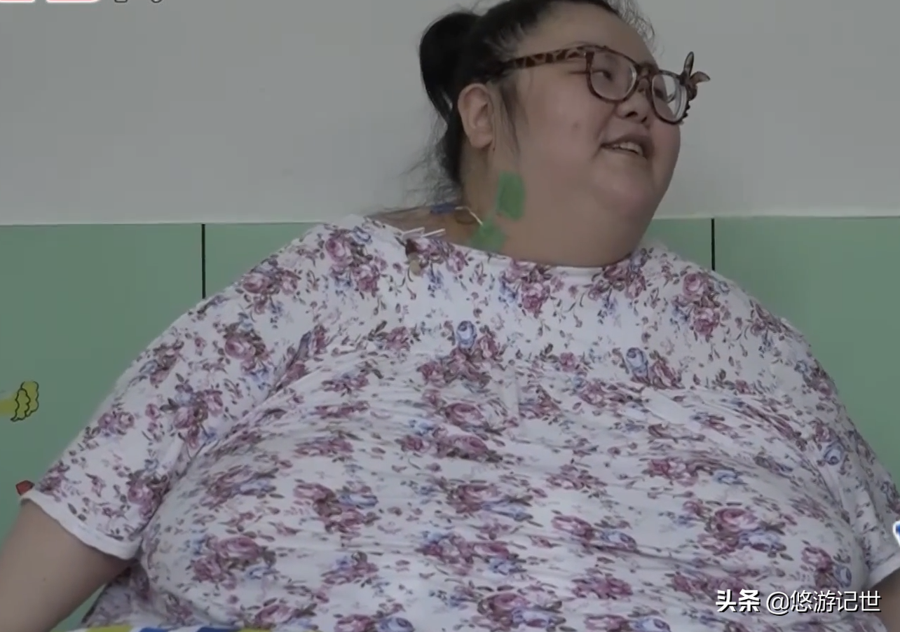 中国第一胖女孩重488斤,手术后狂减300多斤,减肥成功堪比整容