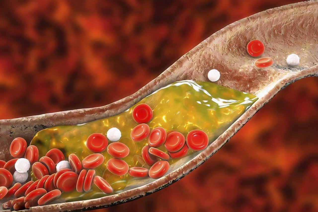 血脂对人体有好处吗?血脂降到这个水平才理想