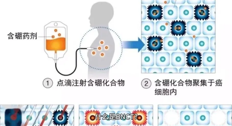 中国首款抗癌硼药将面世:30分钟杀死癌细胞!价格或为10万左右