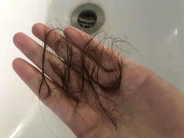 掉头发严重是什么原因女性(女性经常"掉发",是怎么回事?