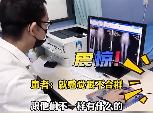 女大学生要求“截骨变矮”，竟是为了要“合群”，真实身高亮了