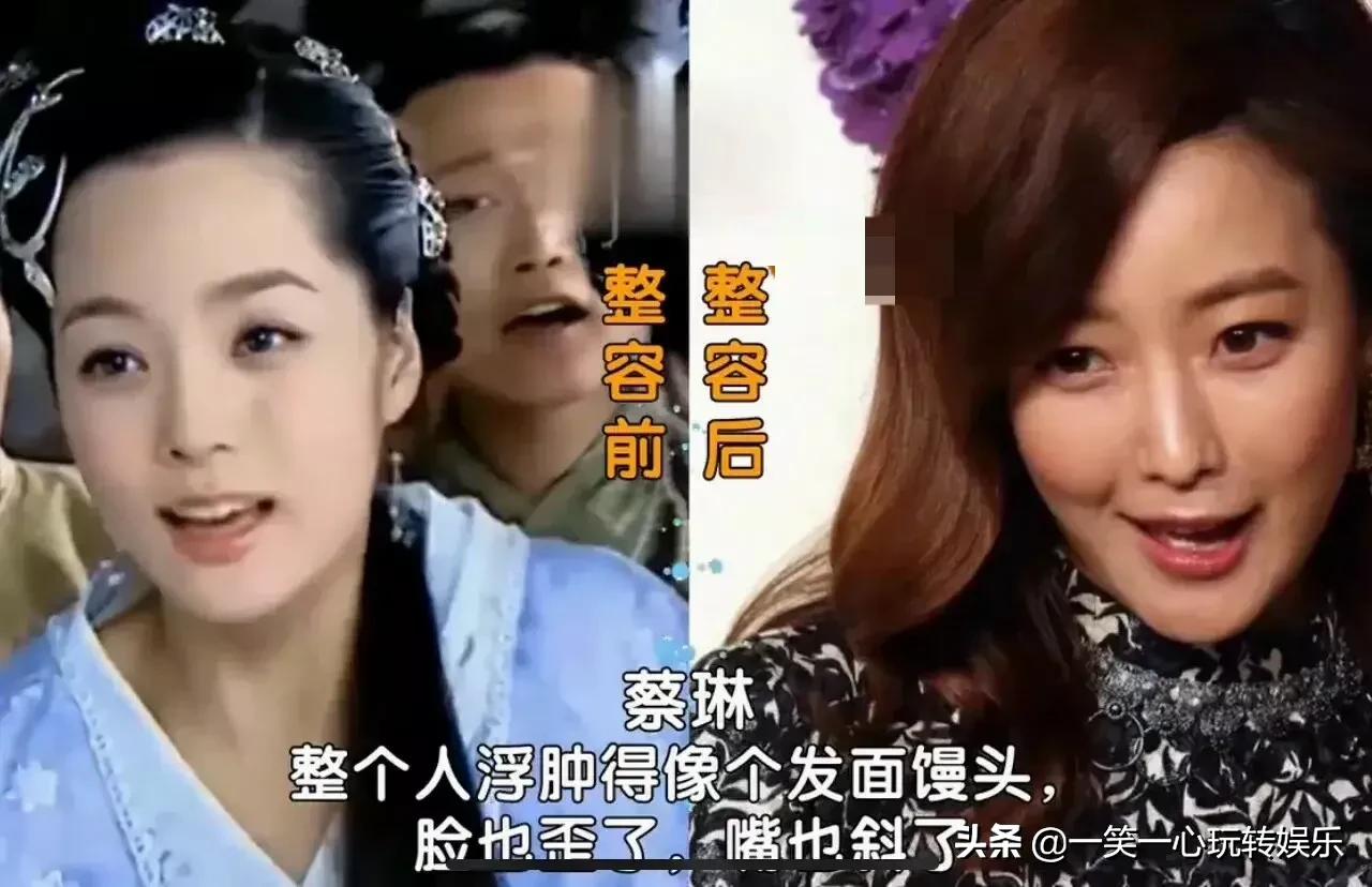 韩国明星变美“后遗症”，朴春360度崩盘，李多海变僵尸脸