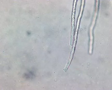 一文揭示,水产养殖中水霉菌繁殖和侵染过程