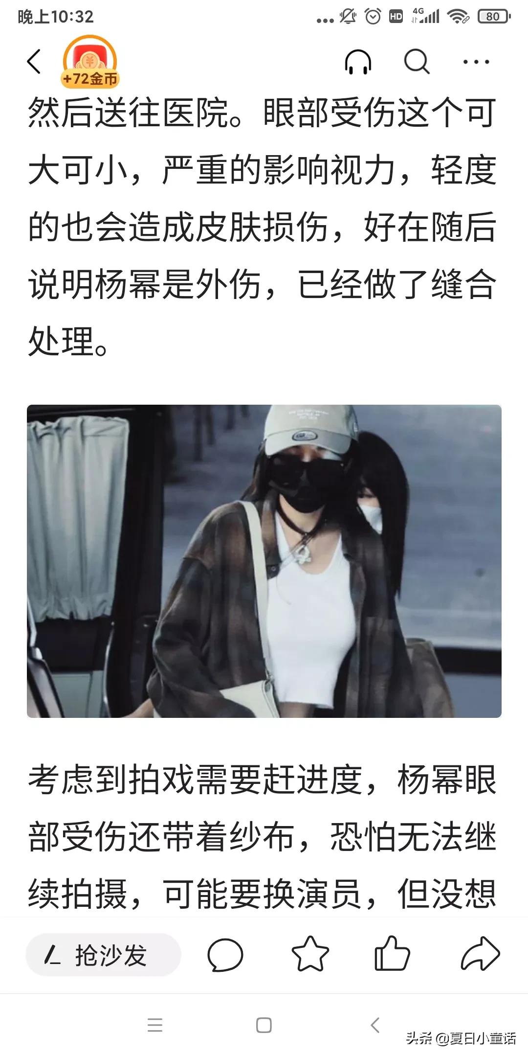 杨幂已经复工，面部不见疤痕