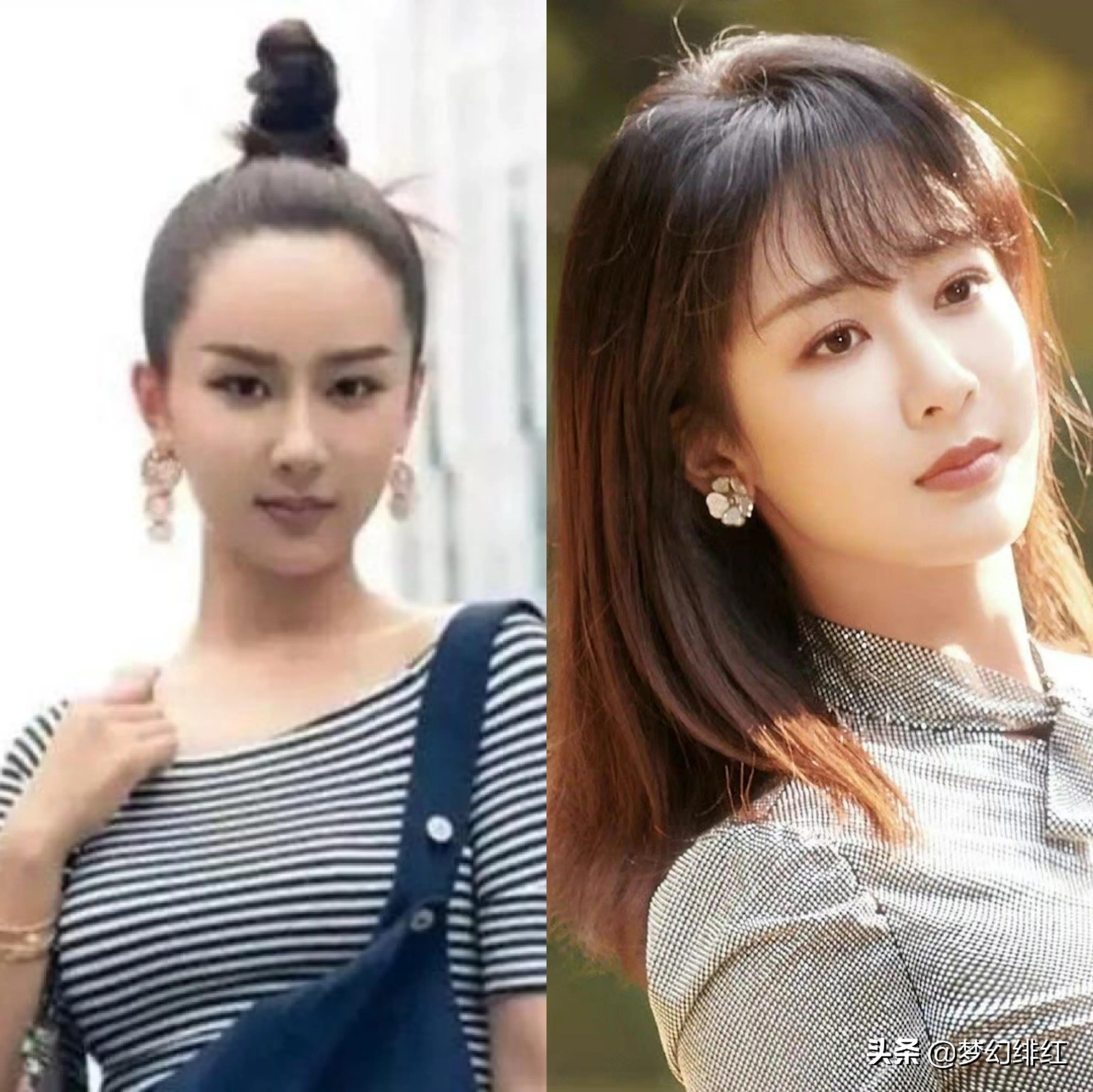 程潇、迪丽热巴、倪妮、IU 泫雅、杨紫教你如何克服“发际线后移”