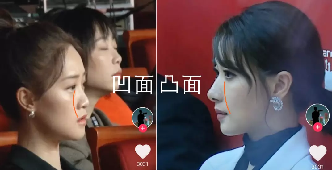 鼻子塌不可怕，面中凹才拉胯，显苦显凶还显老，许多女星深受其害