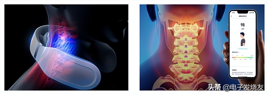 未来穿戴创业板IPO获受理！颈椎按摩仪全国销量第一
