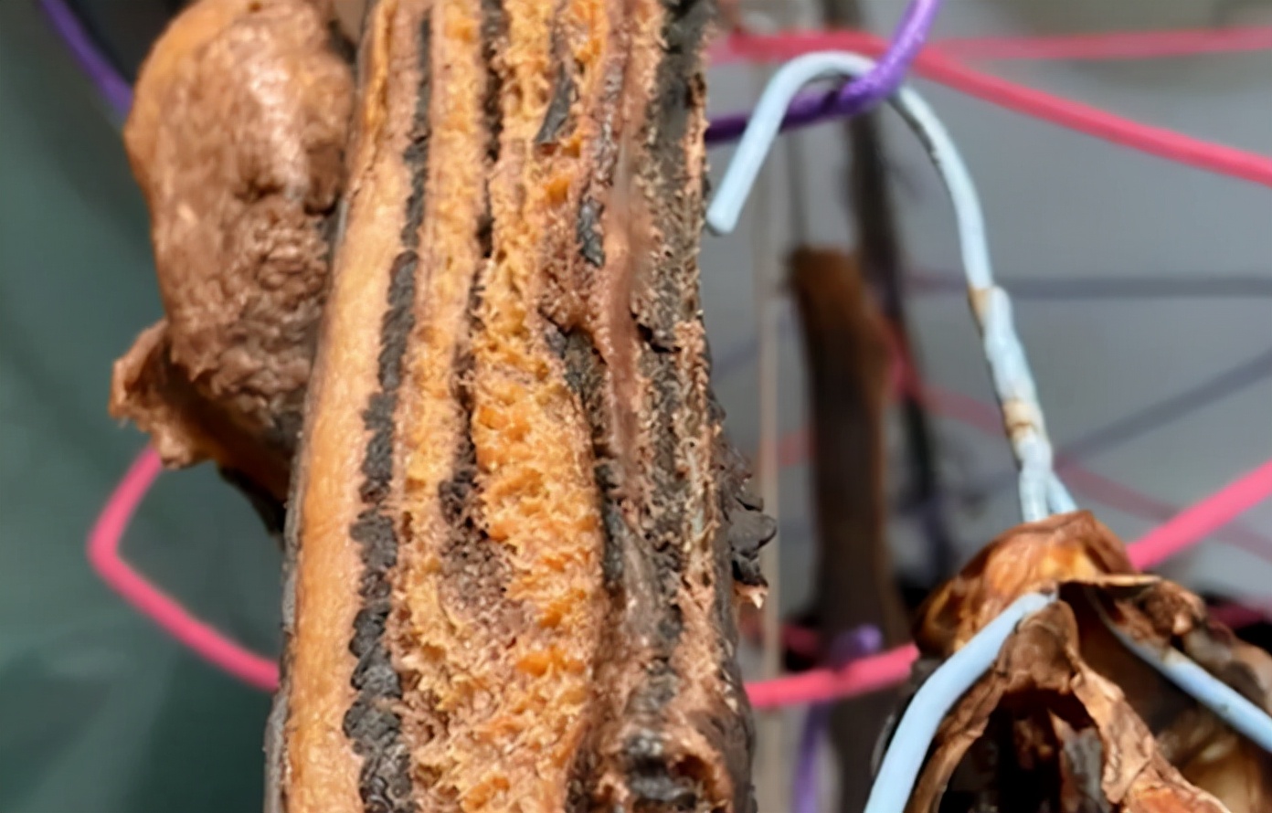 腊肉长蛆了还能吃吗(腊肉臭了还能吃吗)