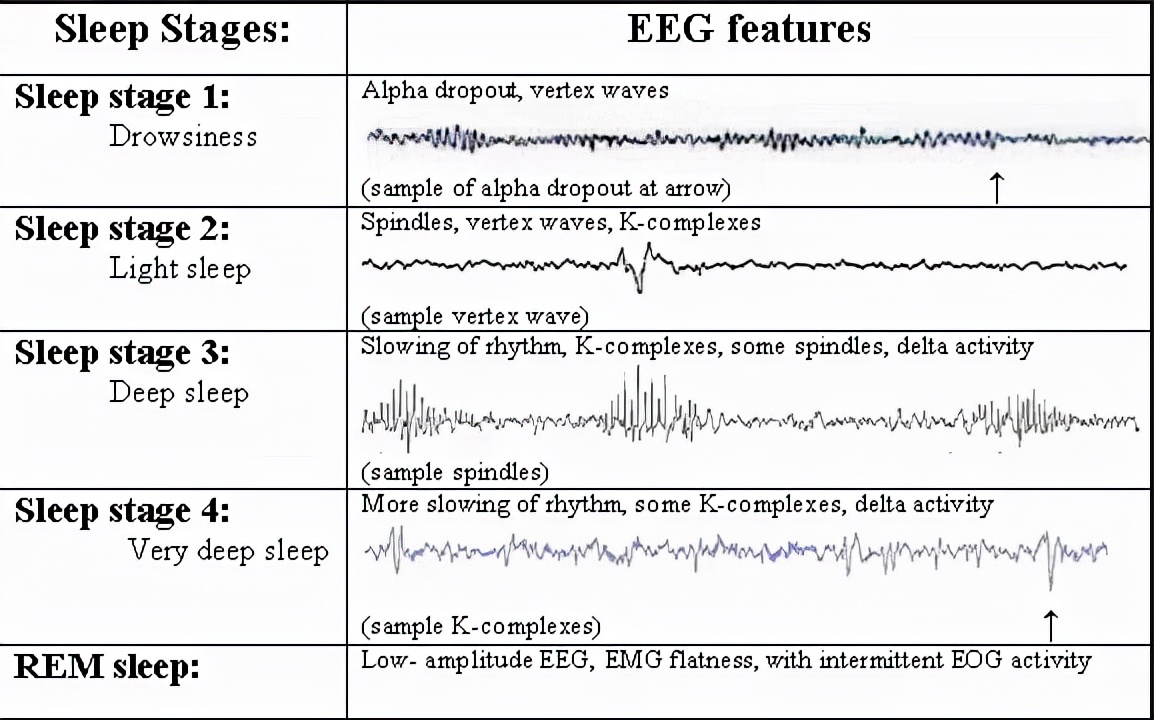 「国际睡眠日」深度睡眠多短才算短？该怎么提高呢？