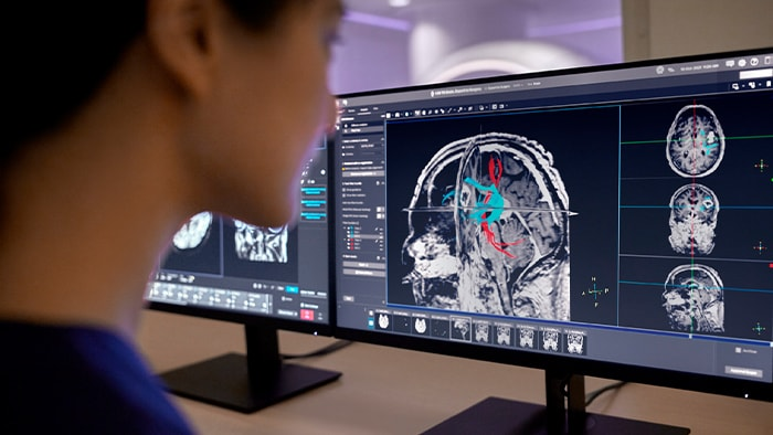 兼容性最强，飞利浦MR人工智能软件获批