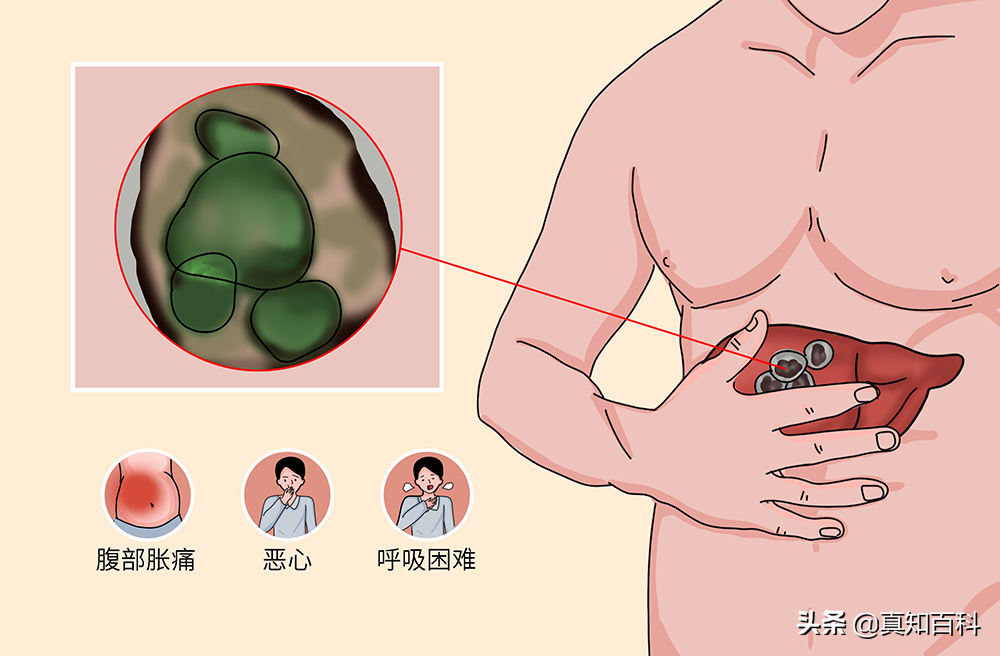 被炒到4000万的藏獒，如今沦为火锅食材，谁戳破了藏獒市场的泡沫