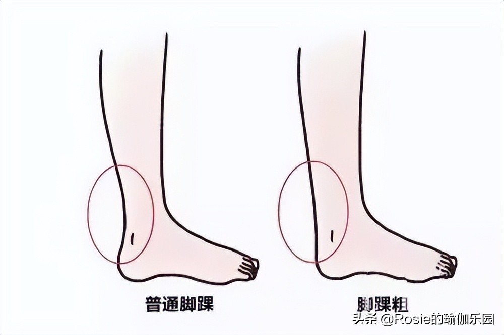 脚踝粗不自信，4步带你瘦腿瘦小脚踝，像阿雅一样自信成女王