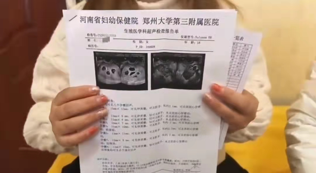 郑州怀八胞胎女子年仅18岁，其丈夫确认曾打过促排卵针，希望能保住一个或两个，减胎手术或在下周进行