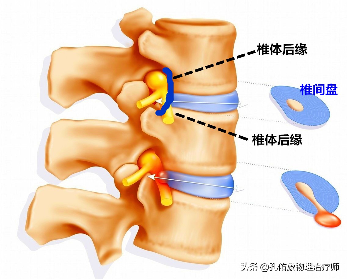 患了颈椎病，会有哪些症状？该如何治疗？