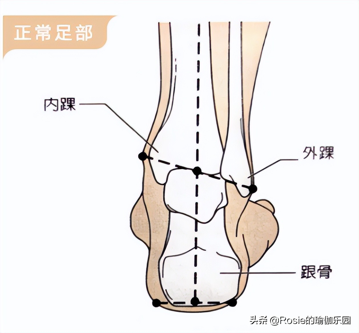 胫骨后缘的位置图图片