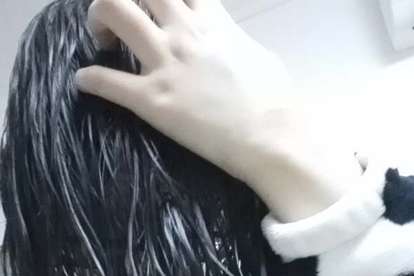 为什么头皮屑非常多？是病吗？洗发水成分和洗头习惯也要注意