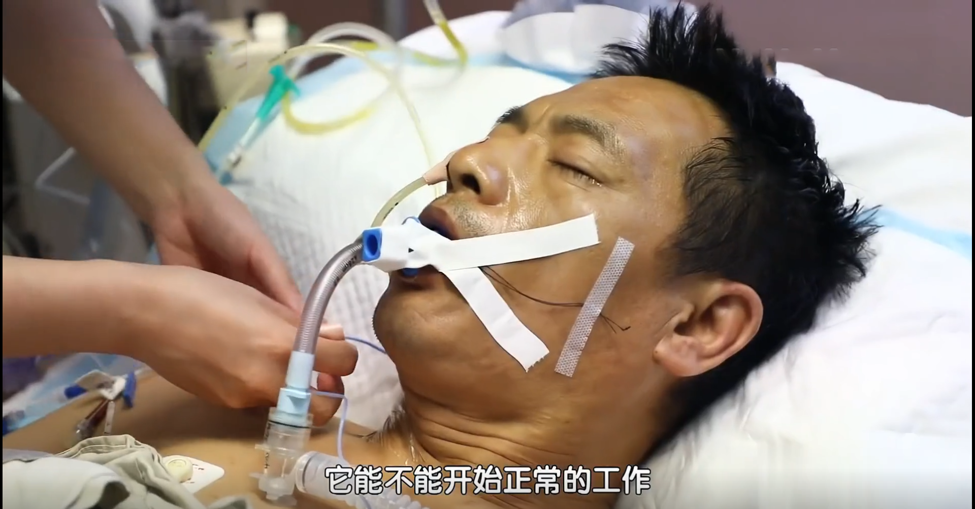 2018年，内蒙古一父亲身患绝症生命垂危，独生子力排众议割肝救父