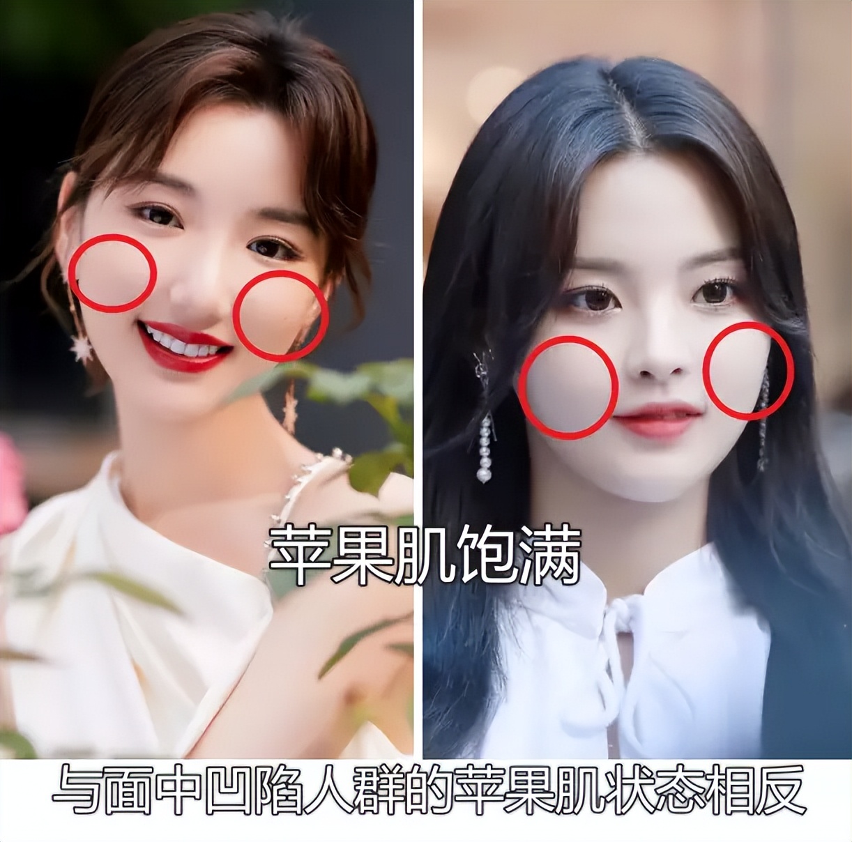 鼻子塌不可怕，面中凹才拉胯，显苦显凶还显老，许多女星深受其害