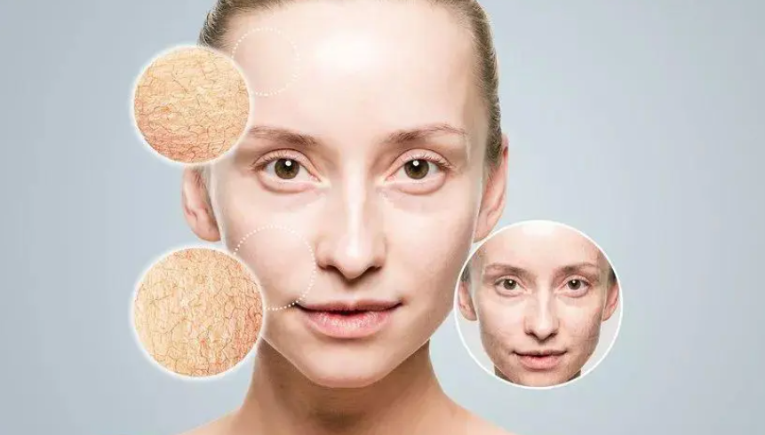 如何修复皮肤屏障功能