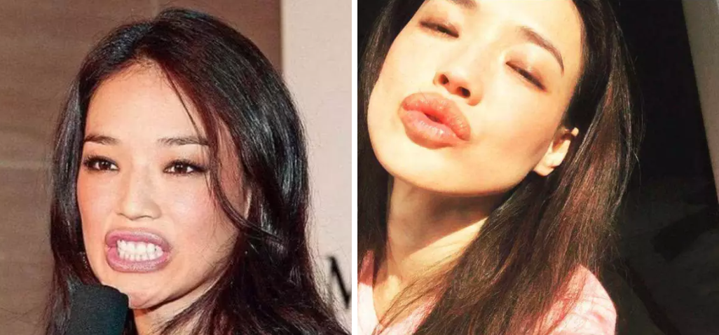 6位“香肠嘴”、大嘴女星：有人被夸风情万种，有人被嘲嘴大难看