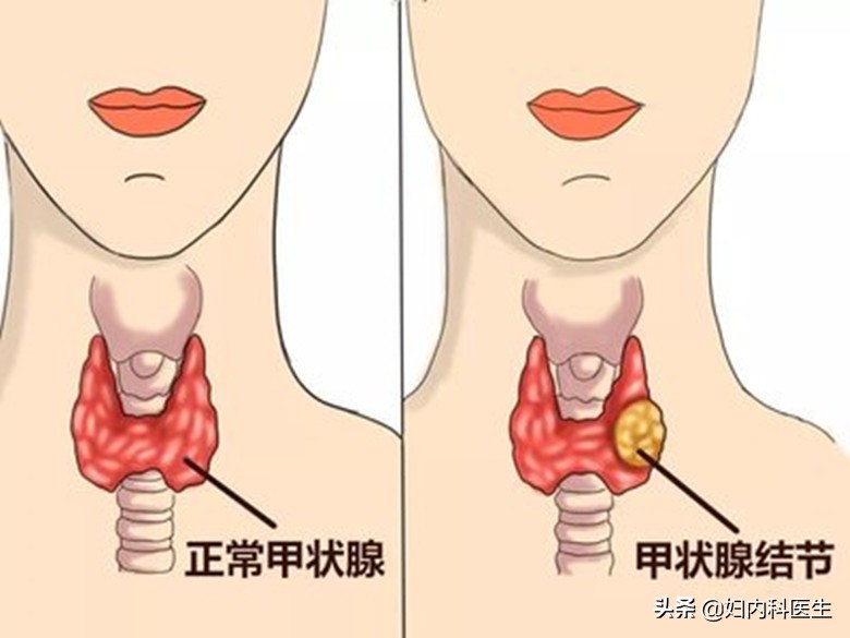 检查出来的一些病根本不需要担心，花冤枉钱治疗，别再傻傻地骗了