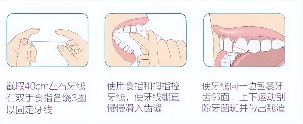 【健康口腔行动】清洁口腔很重要，刷牙漱口用牙线
