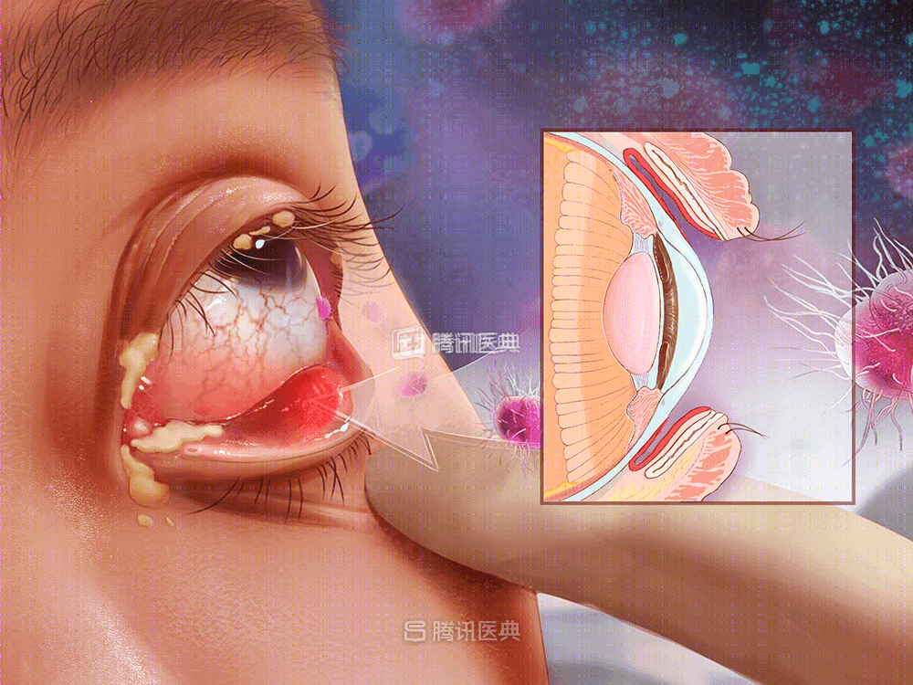 不停流泪却很干涩，我的眼睛变成了吸水的无底洞