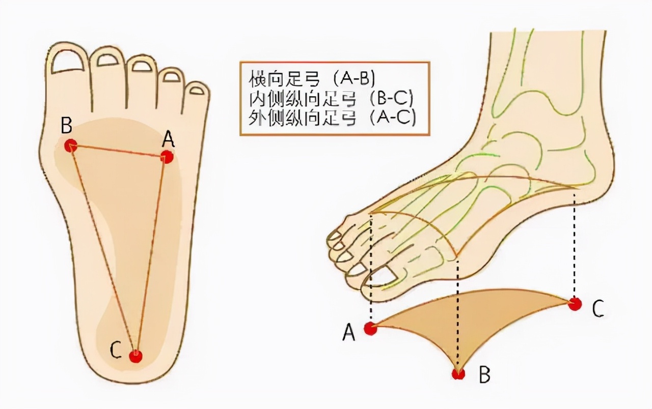 脚底板爱生茧子,走路疼痛是怎么回事?或是这些部位出现了问题