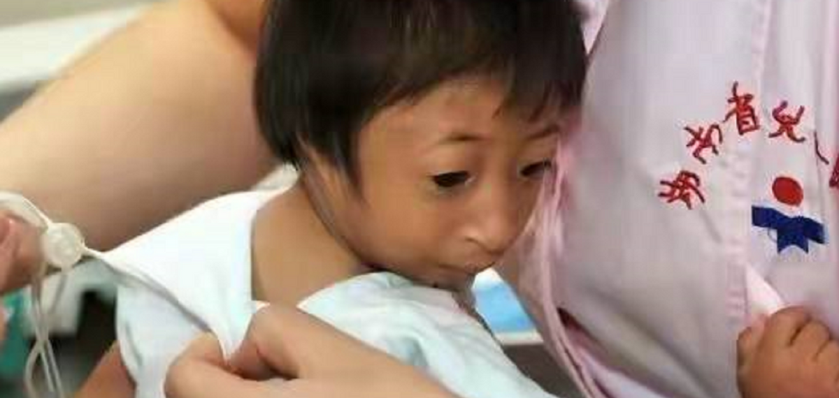 2009年，湖南女子生下重2斤“小猴子”，坐出租车被拒载：坐不下