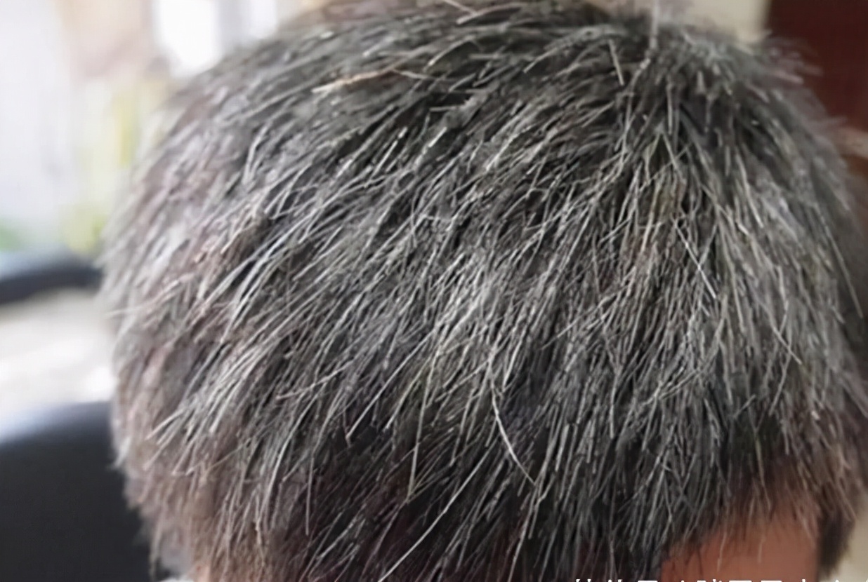 反应男性衰老的标志是什么？“1臭2大2小”，男性要有所了解