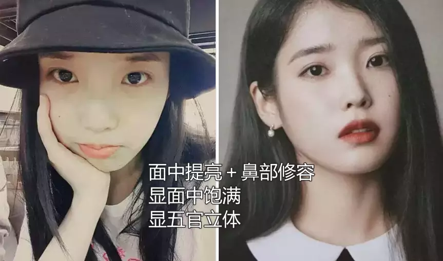 鼻子塌不可怕，面中凹才拉胯，显苦显凶还显老，许多女星深受其害
